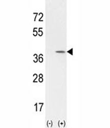 Western blot analysis of CCND1 antibody ans 293 cell lysate (2 ug/lane) either nontransfected (Lane 