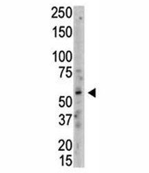 PRMT3 Antibody