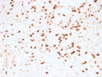 IHC testing of FFPE human tonsil stained with Lambda Light Chain antibody (clone N10/2). Required HI