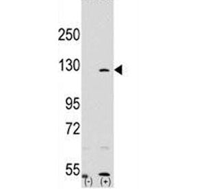 PARP1 Antibody, 0.08ml