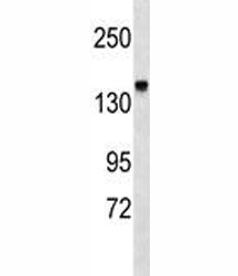 Integrin alpha 2 Antibody (ITGA2)