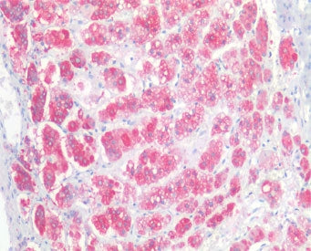 NCAM Antibody (isoform 2)