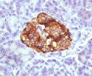 Insulin Antibody