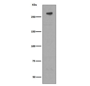 IGF2R Antibody / M6PR