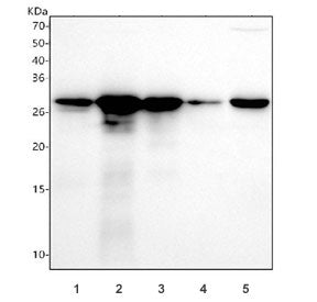 Western blot testing of 1) human A431, 2) human SiHa, 3) human RT4, 4) human MCF7 and 5) rat PC-12 c