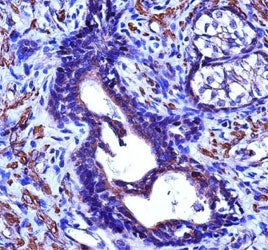 ACTG2 antibody immunohistochemistry analysis in formalin fixed and paraffin embedded human prostate 