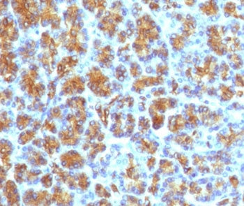 CELA3B Antibody / Elastase 3B