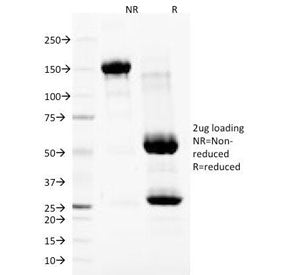 SDS-PAGE Analysis of Purified, BSA-Free Nuclear Membrane Marker Antibody (clone NM97). Confirmation 