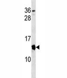 Cdkn2a Antibody