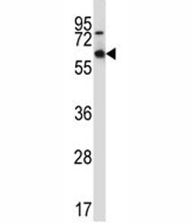 MEF2D Antibody