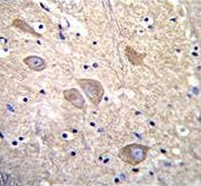 VILIP1 Antibody / Visinin-like protein 1