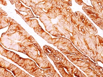 Cytokeratin 5/8 Antibody