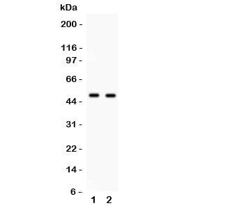 Western blot testing of E2F3 antibody and 1. HeLa, 2. COLO320 cell lysate. Expected/observed molecul