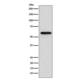 RARB Antibody / Retinoic Acid Receptor beta