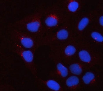 Apolipoprotein E Antibody / APOE