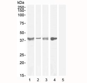 Asporin Antibody