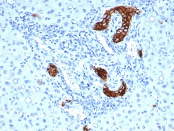 TROP2 Antibody / TACSTD2