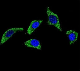 TNFR Antibody