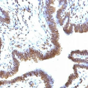 EMI1 Antibody (Early Mitotic Inhibitor-1)