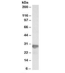Western blot testing of HeLa lysate with NNMT antibody at 0.3ug/ml. Predicted molecular weight: ~29k
