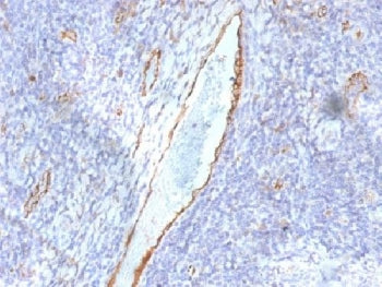 von Willebrand Factor Antibody / vWF