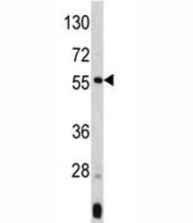 ANGPTL3 Antibody