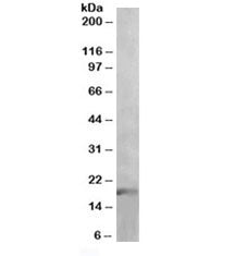Western blot testing of human thymus lysate with IL-17 antibody at 1ug/ml. Expected molecular weight