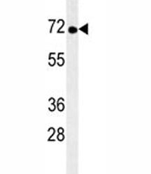 TNK1 Antibody