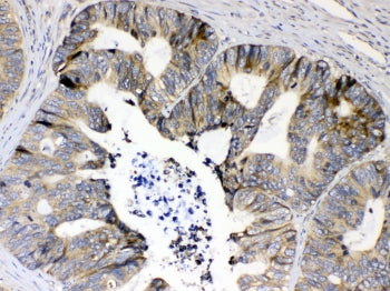 RPS6 Antibody