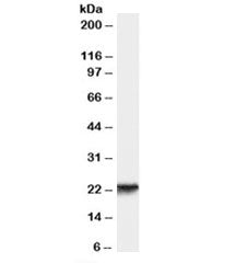 Western blot testing of human skin lysate with RBP4 antibody at 0.3ug/ml. Predicted molecular weight