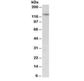 PTCH1 Antibody