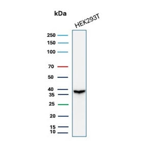 Western blot testing of human 293T cell lysate with recombinant Aldose reductase 1B1 antibody (clone
