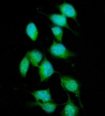 Immunofluorescent staining of FFPE human HeLa cells with XPC antibody (green) and DAPI nuclear stain