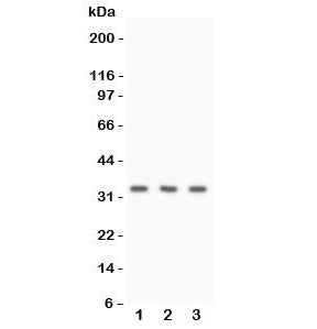 Calponin Antibody