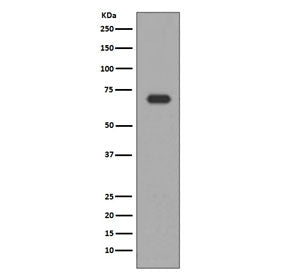 ALAS1 Antibody
