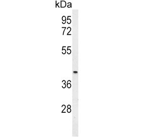 Western blot testing of mouse heart tissue lysate with Mu-type Opioid Receptor antibody. Predicted m