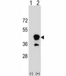 CD1b Antibody