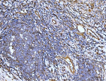Migfilin-1 Antibody / FLNB / Filamin B