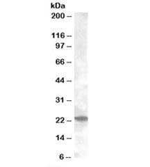 Western blot testing of mouse kidney lysate with Rab17 antibody at 0.2ug/ml. Predicted/observed mole