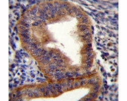 Cyclin B1 antibody immunohistochemistry analysis in formalin fixed and paraffin embedded human uteru