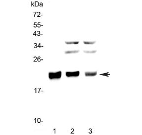 CBFB Antibody / Core-binding factor subunit beta