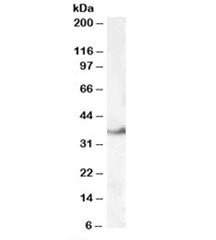 LASP1 Antibody