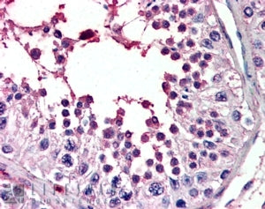 PIAS2 Antibody