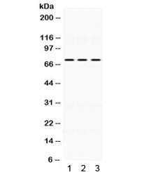Western blot testing of human 1) HeLa, 2) MCF7 and 3) SW620 lysate wtih KEAP1 antibody. Expected/obs