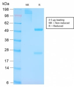 SDS-PAGE analysis of purified, BSA-free p53 antibody (clone TP53/3156R) as confirmation of integrity