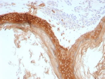 Basic Cytokeratin Antibody (HMW / Type II)