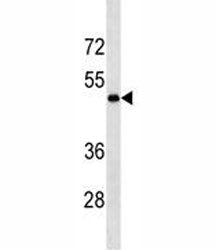 LOX Antibody