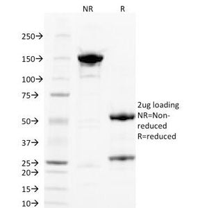 SDS-PAGE Analysis of Purified, BSA-Free PLGF Antibody (clone PLGF/93). Confirmation of Integrity and