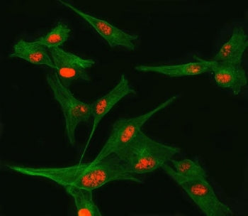 Immunofluorescent staining of FFPE human U-87 MG cells with TSEN34 antibody (red) and Beta Tubulin m