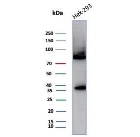 HSP70 Antibody / HSPA1B